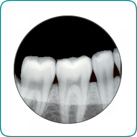 Cabinet stomatologic STOMSAN Dristor - servicii radiologie dentara Cabinet stomatologic STOMSAN Dristor - servicii radiologie dentara